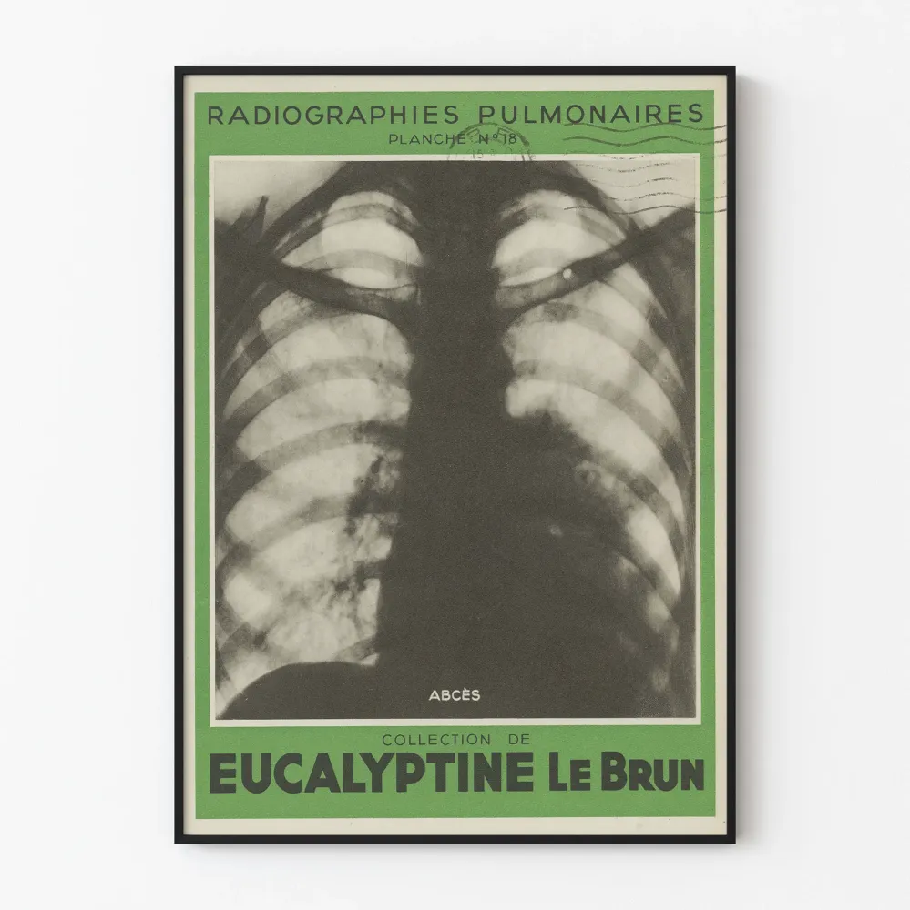 Ilmakuva keuhkokuva - paise - lääketieteellinen seinäkoriste vintage-tyylinen Poster