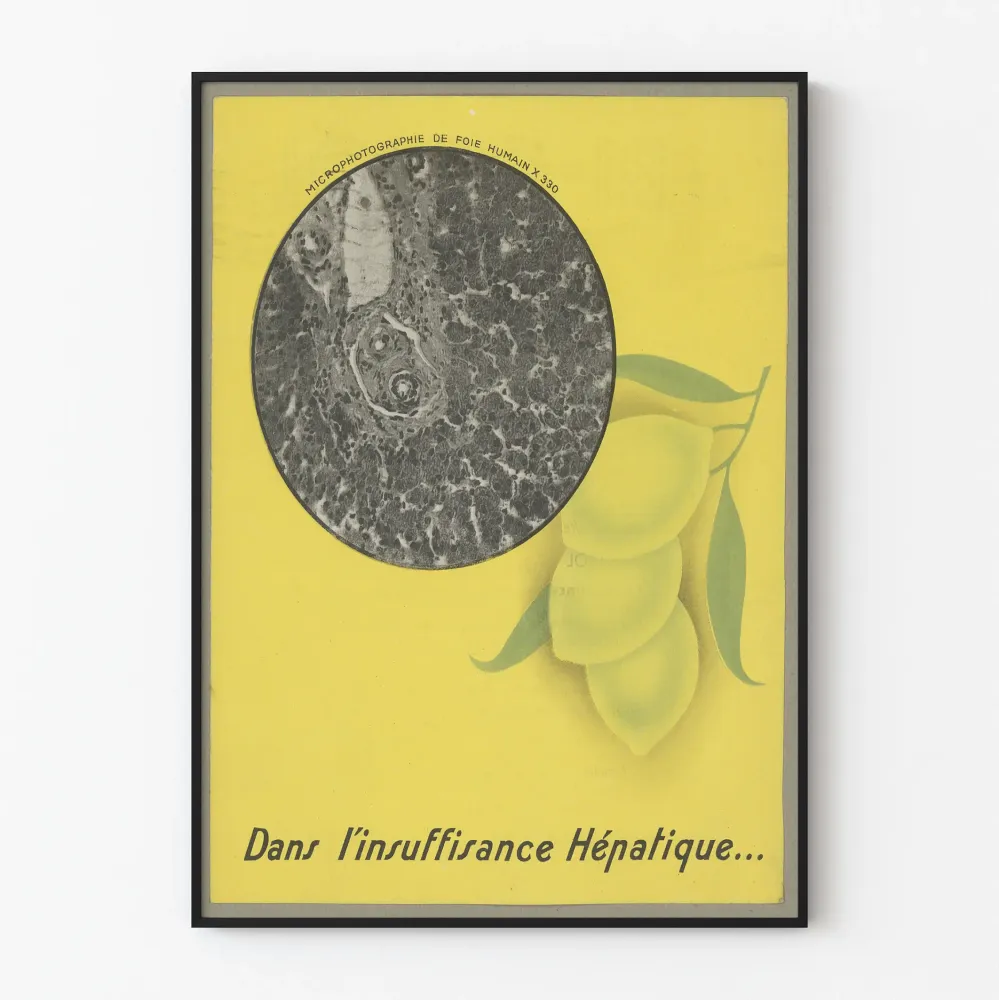 Vintagemedicalinen juliste maksavajeesta